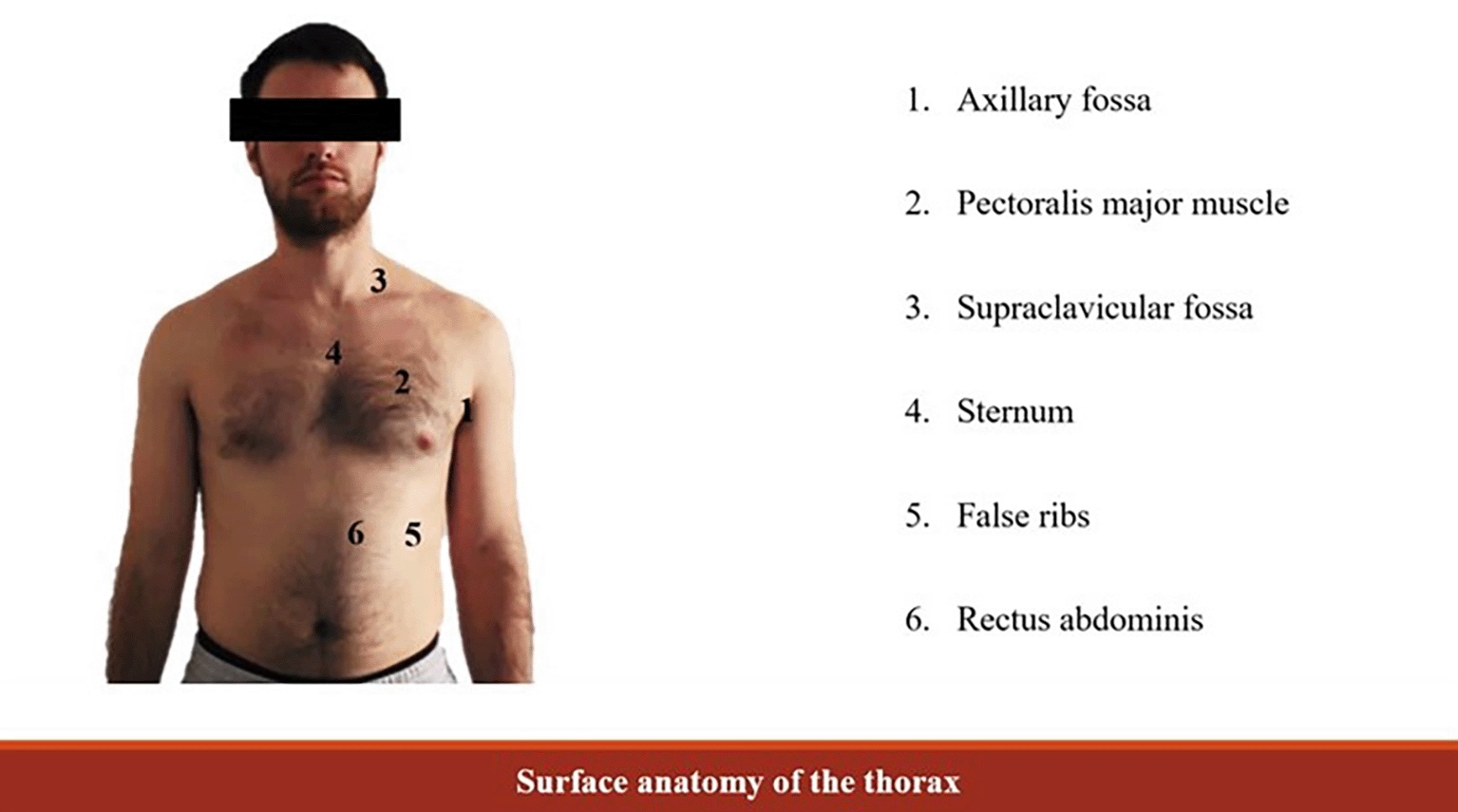 Normal Rib Skin Surface Anatomy Of Ribs Mededpublish Art Anatomy An Everlasting